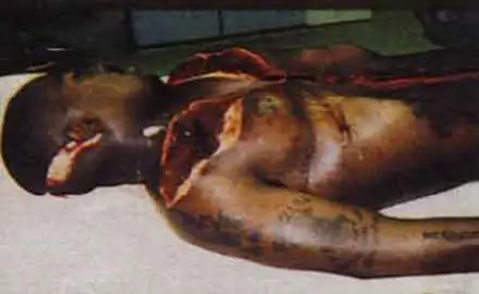 2pac - autopsy.jpg